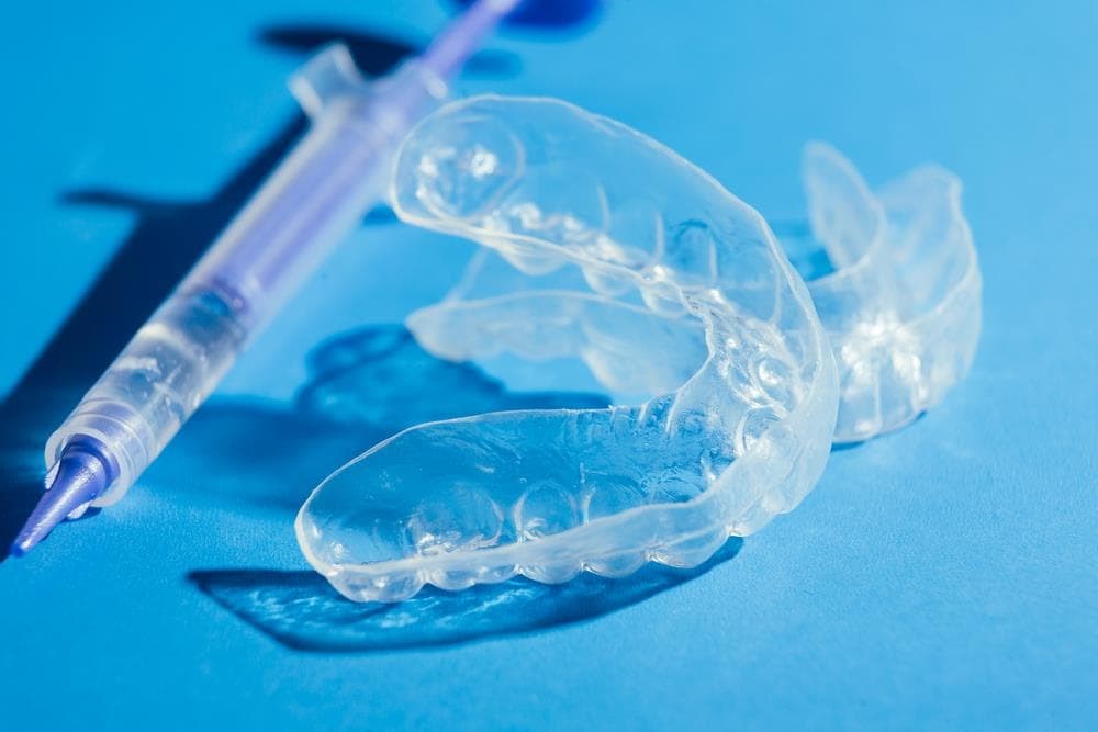 5 consejos para mantener limpio su retenedor dental