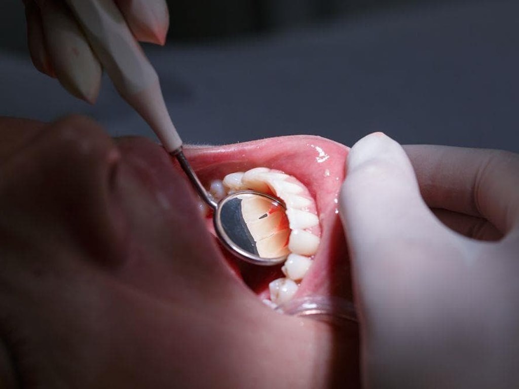 6 cosas que no sabías sobre la enfermedad periodontal