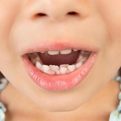 ¿A qué edad se le caen los dientes de leche a los niños?