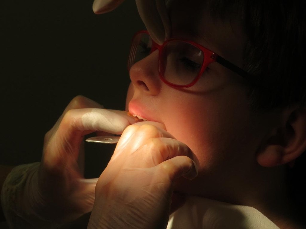 ¿Cada cuánto es necesaria la limpieza dental para niños?