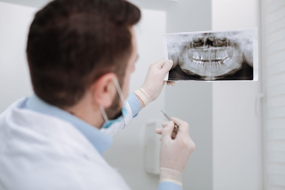 Causas de la pérdida de hueso dental