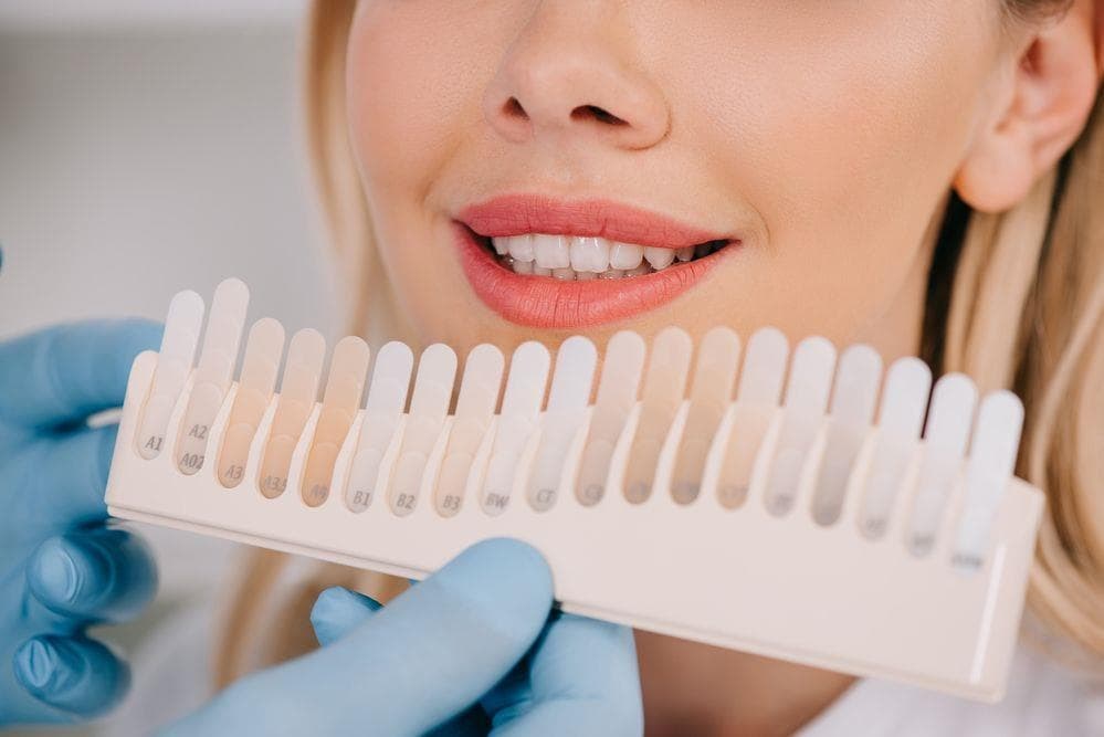 ¿Cómo alargar un blanqueamiento dental?