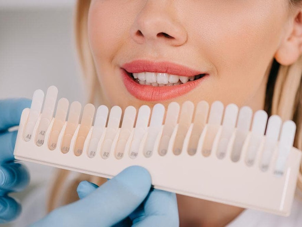 ¿Cómo alargar un blanqueamiento dental?