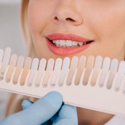 ¿Cómo alargar un blanqueamiento dental?