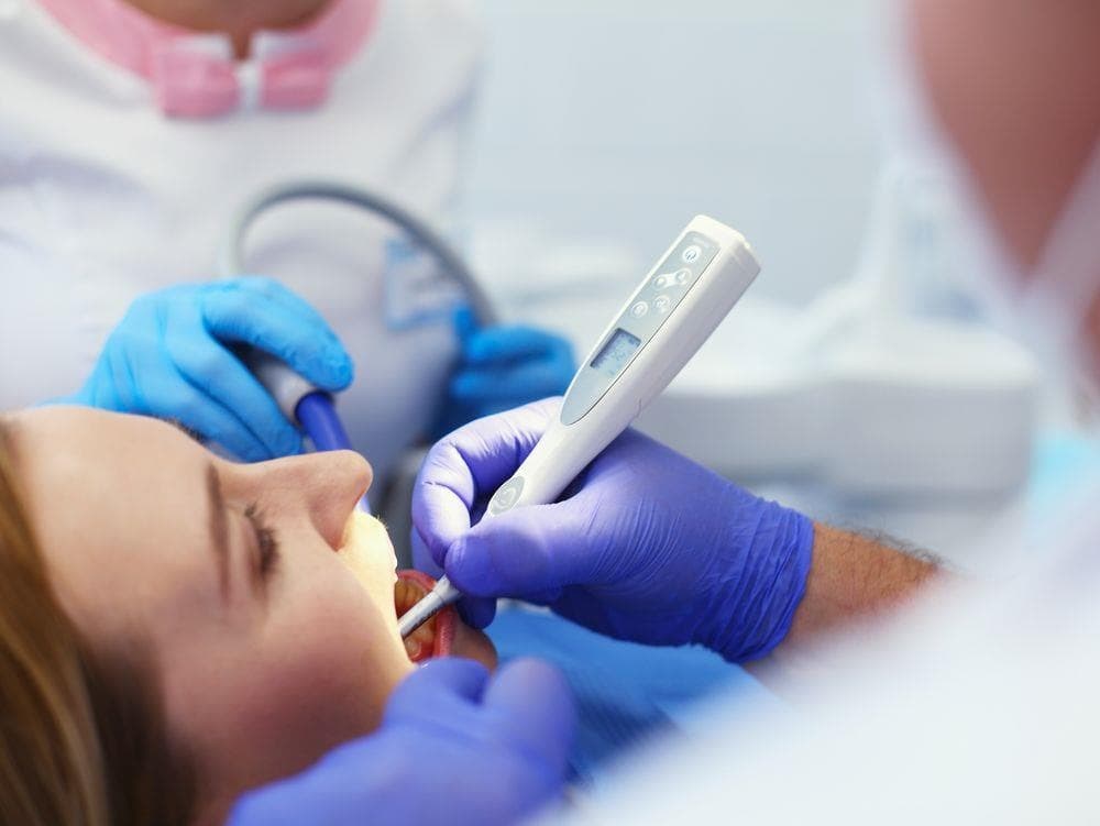 En qué consiste la limpieza dental por ultrasonido