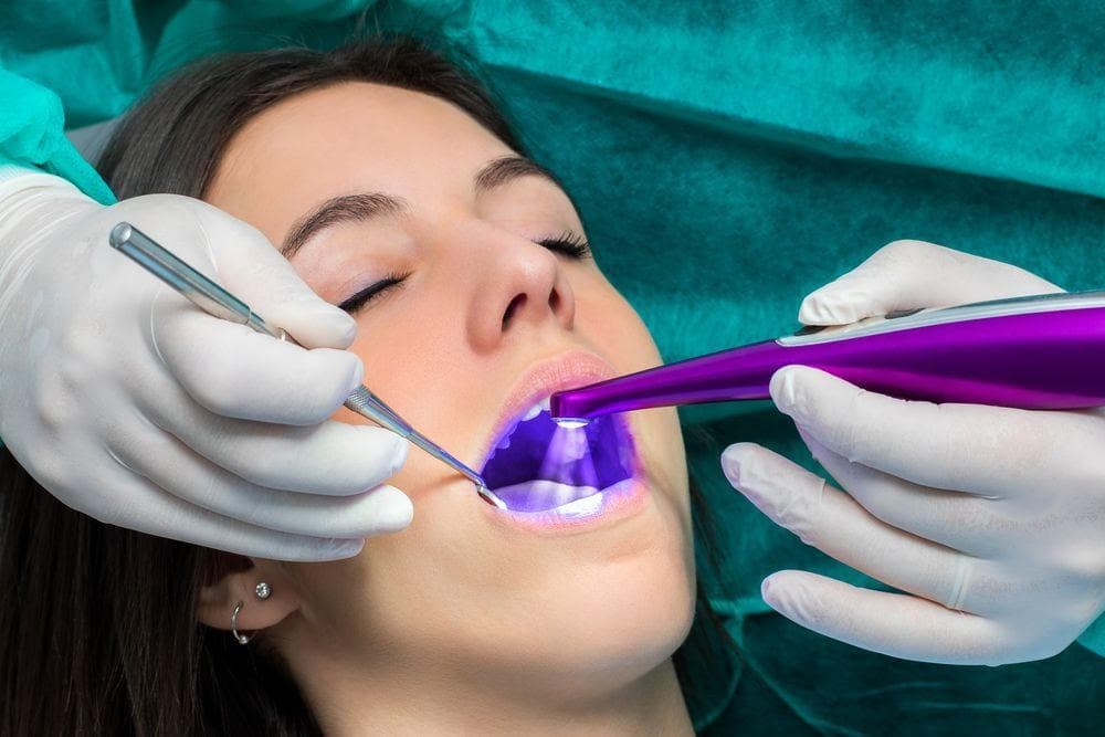 Fisuras dentales: ¿cómo se producen? - Imagen 1