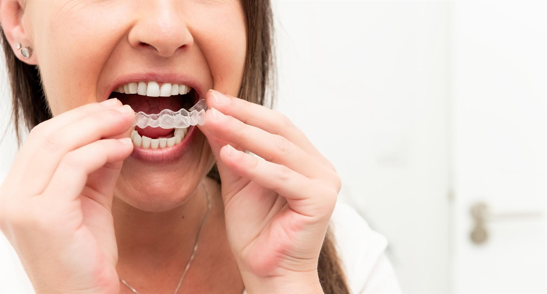 Expertos en tratamientos de ortodoncia invisible: Invisalign