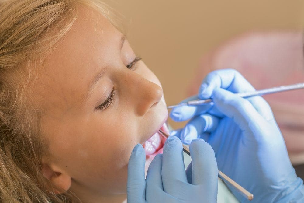 La importancia de prevenir las caries infantiles