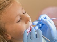 La importancia de prevenir las caries infantiles