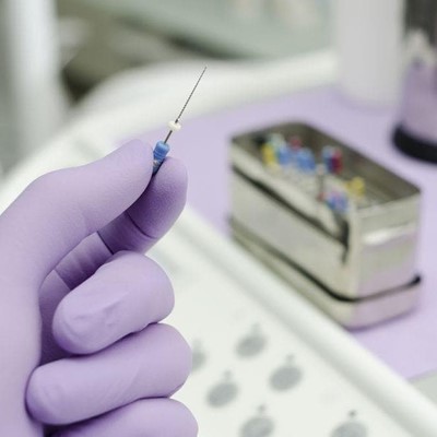 ¿Qué es una endodoncia y cuáles son sus causas?